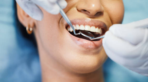Best Emergency Root Canal Treatment in Hartford, CT