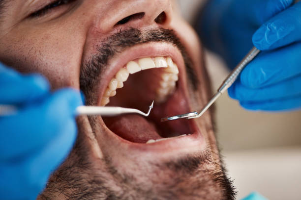 Best Broken or Cracked Tooth Emergency Dentist in Hartford, CT